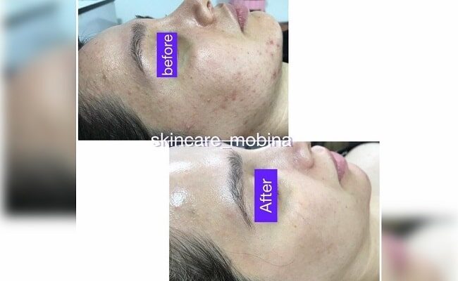 skincare mobina