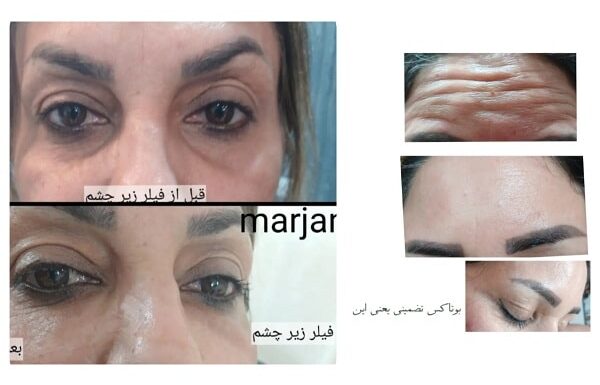 مارینا در آبادان