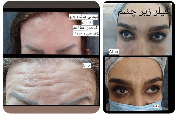 مارینا