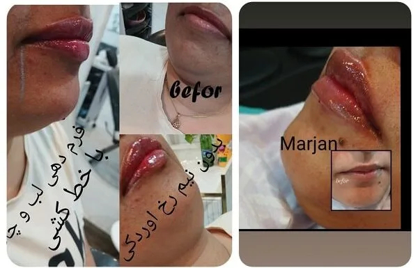 کلینیک زیبایی مارینا در آبادان
