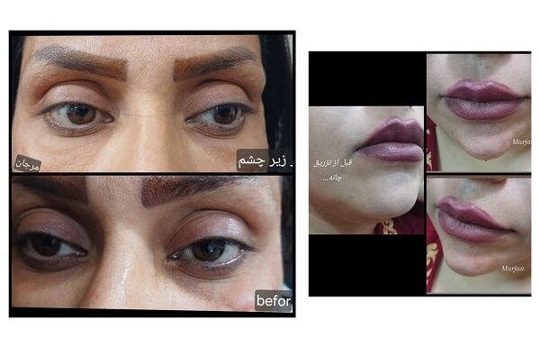 کلینیک زیبایی مارینا