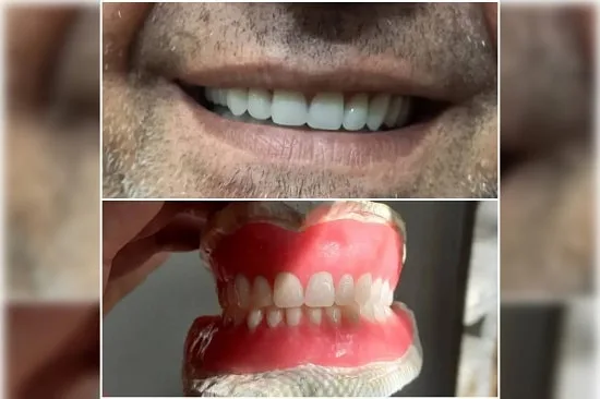 دندانسازی دکتر بیژن فر