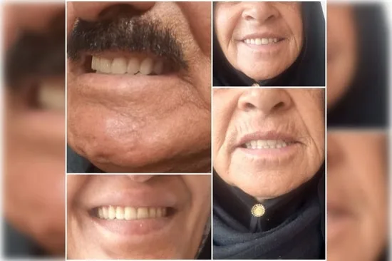 دندانسازی دکتر بیژن فر در مشهد