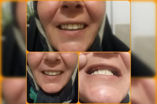 دکتر بیژن فر در مشهد