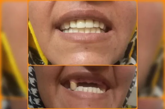 لابراتوار دندانسازی در مشهد