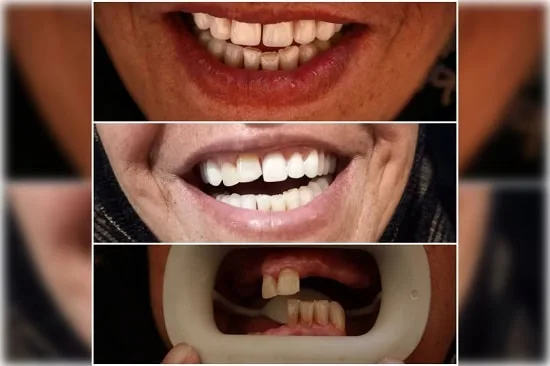 دندانسازی بیژن فر1