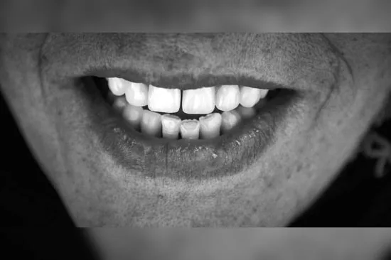 دندانسازی بیژن فر4