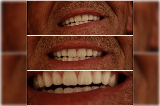 دندانسازی بیژن فر6