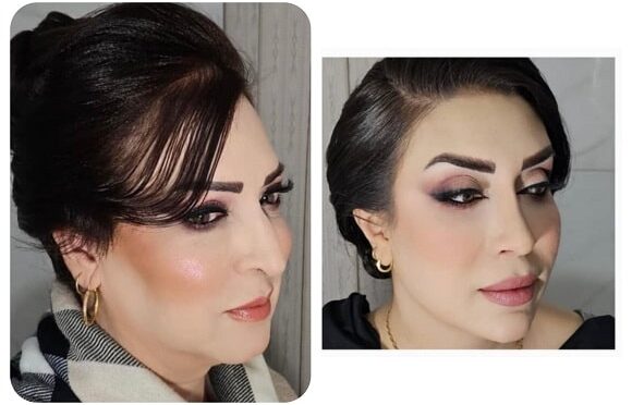 سالن کلاژن