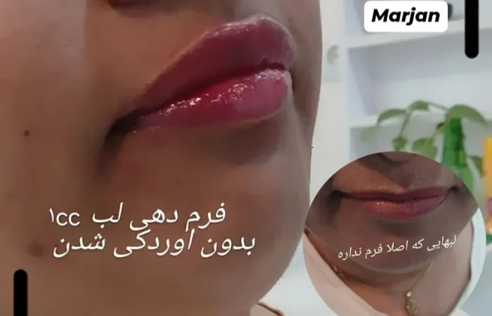 کلینیک زیبایی مارینا در آبادان