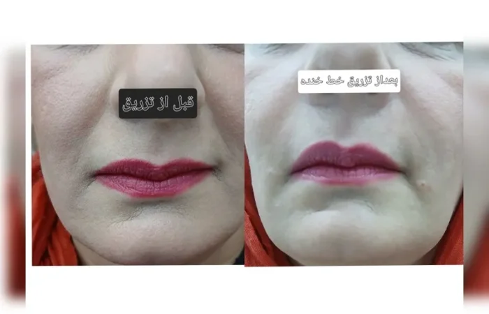 کلینیک زیبایی مارینا در آبادان1