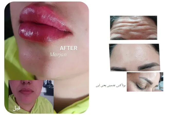 کلینیک زیبایی مارینا در آبادان2