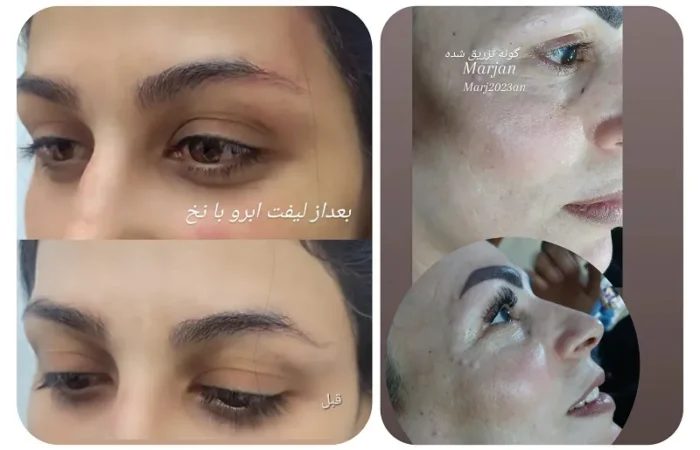 کلینیک زیبایی مارینا در آبادان4