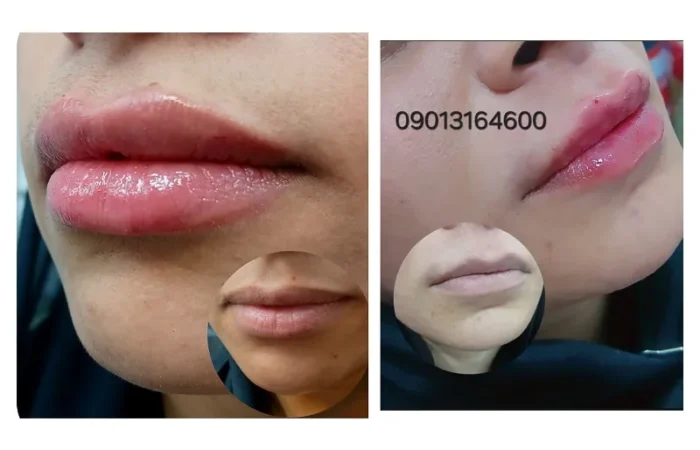 کلینیک زیبایی مارینا در آبادان5
