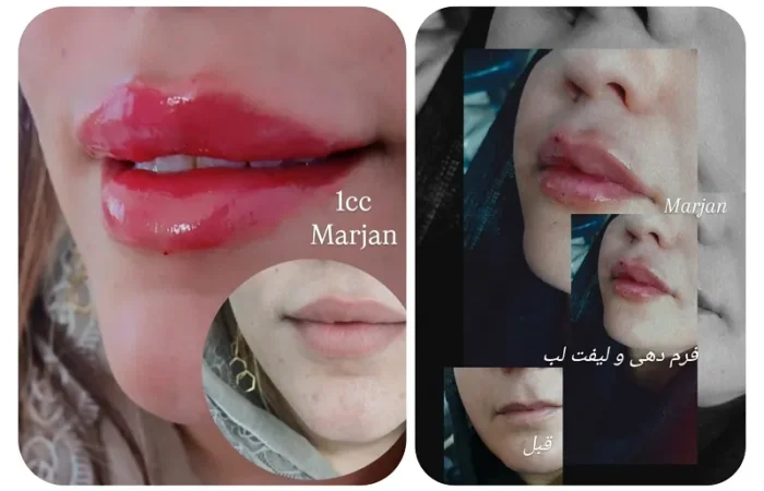 کلینیک زیبایی مارینا در آبادان12