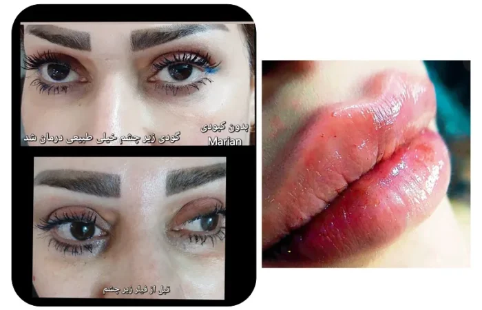 کلینیک زیبایی مارینا در آبادان13