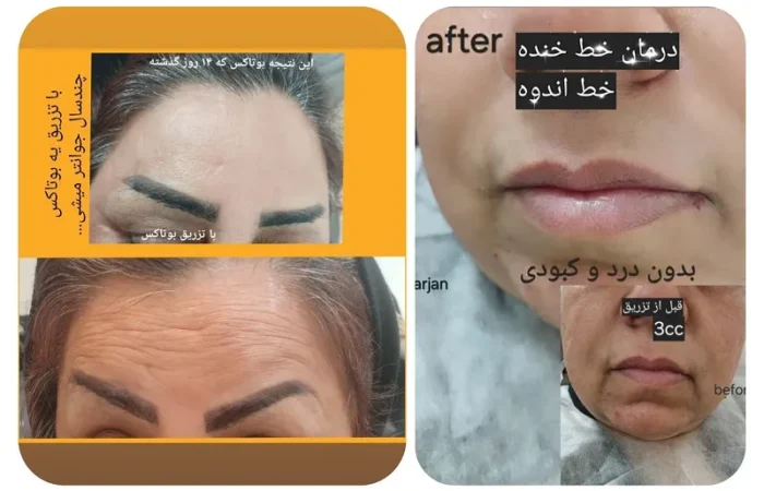 کلینیک زیبایی مارینا در آبادان14