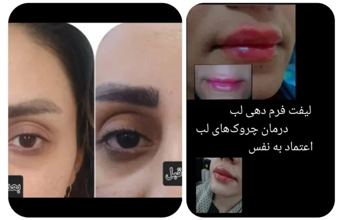 کلینیک زیبایی مارینا در آبادان16